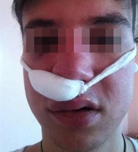 Разярени шофьори се биха в Благоевград, единият е със счупен нос